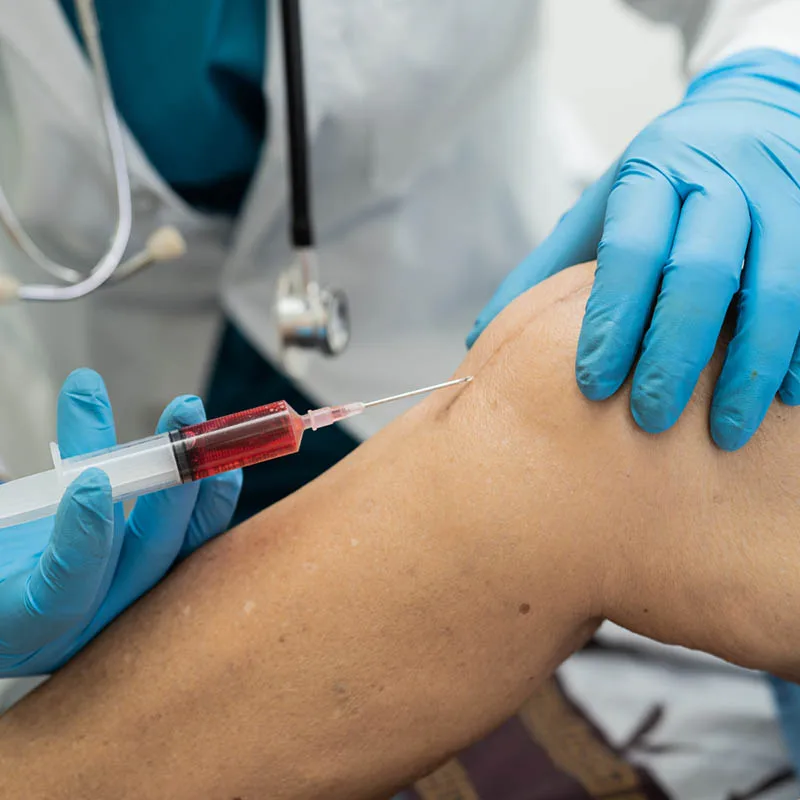 How Stem Cell Extraction Works